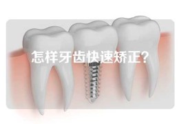 怎样牙齿快速矫正？