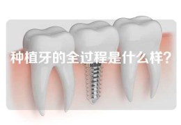 种植牙的全过程是什么样？