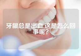 牙龈总是出血,这是怎么回事呢？