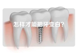 怎样才能把牙变白？