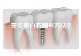 牙齿美白有哪些方法？