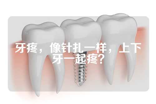 牙疼，像针扎一样，上下牙一起疼？