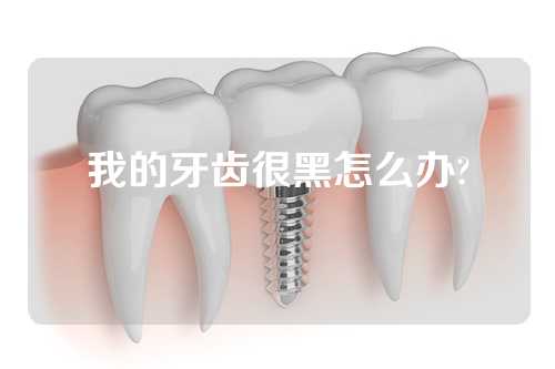 我的牙齿很黑怎么办?