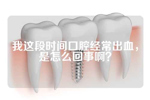 我这段时间口腔经常出血，是怎么回事啊？