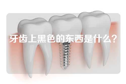 牙齿上黑色的东西是什么？