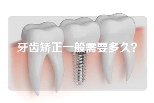 牙齿矫正一般需要多久？