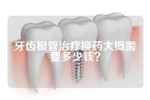 牙齿根管治疗换药大概需要多少钱？