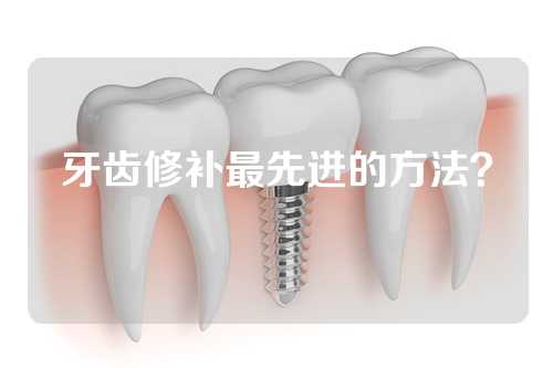 牙齿修补最先进的方法？