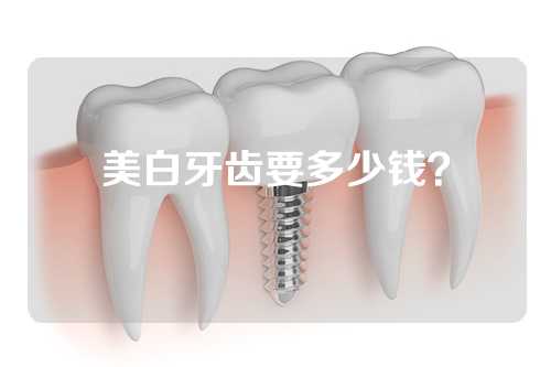 美白牙齿要多少钱？