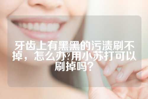 牙齿上有黑黑的污渍刷不掉，怎么办?用小苏打可以刷掉吗？