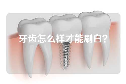 牙齿怎么样才能刷白？