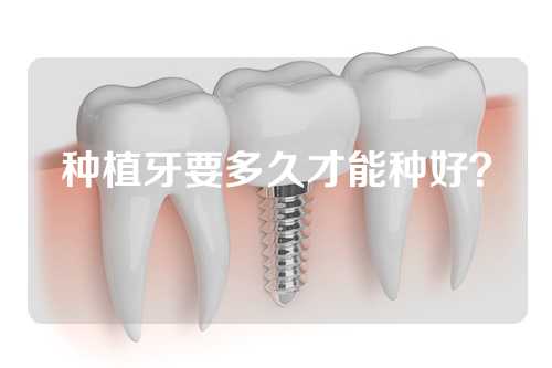 种植牙要多久才能种好？