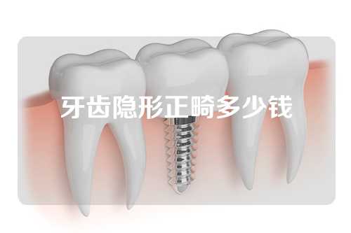 牙齿隐形正畸多少钱