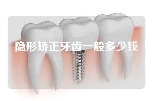 隐形矫正牙齿一般多少钱