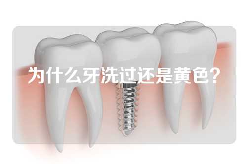 为什么牙洗过还是黄色？