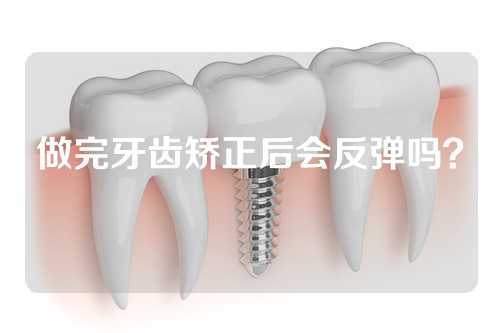 做完牙齿矫正后会反弹吗？